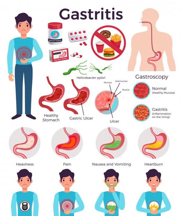 Gastroenterologista: entenda tudo o que o médico do estômago faz